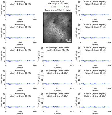 Real-Time Processing of Two-Photon Calcium Imaging Data Including Lateral Motion Artifact Correction